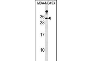 LIN7A Antibody (C-term) (ABIN1536800 and ABIN2848886) western blot analysis in MDA-M cell line lysates (35 μg/lane). (LIN7A antibody  (C-Term))