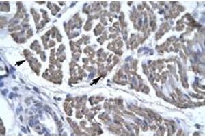 Immunohistochemical staining (Formalin-fixed paraffin-embedded sections) of human skeletal muscle with EYA3 polyclonal antibody  at 4-8 ug/mL working concentration.