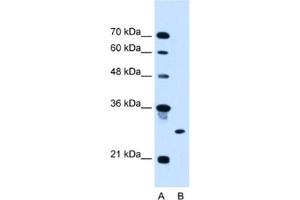 Western Blotting (WB) image for anti-Ring Finger Protein 39 (RNF39) antibody (ABIN2462699) (RNF39 antibody)