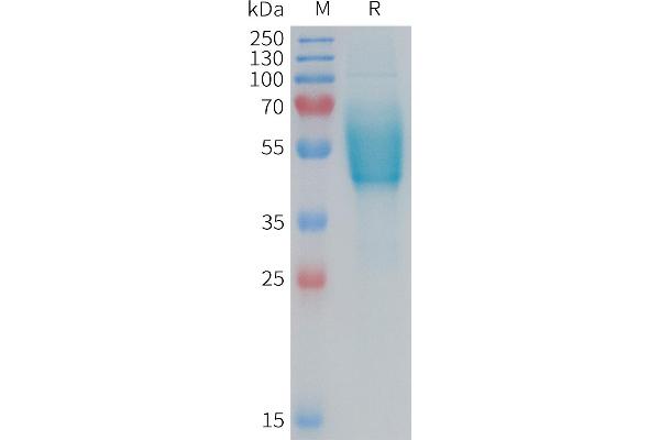 CALCRL Protein (AA 23-140) (Fc Tag)
