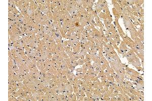 LRP6 Mouse Monoclonal Antibody at 1/100 staining rat heart tissue by IHC-P.