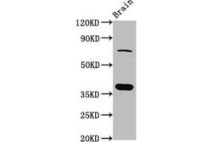 Western Blot Positive WB detected in: Rat brain tissue All lanes: SCAMP1 antibody at 4 μg/mL Secondary Goat polyclonal to rabbit IgG at 1/50000 dilution Predicted band size: 38, 19 kDa Observed band size: 38 kDa (SCAMP1 antibody  (AA 2-134))