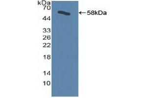 Western Blotting (WB) image for anti-Adrenergic, Beta, Receptor Kinase 1 (ADRBK1) (AA 398-640) antibody (ABIN7440779)