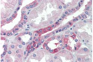 Human Kidney (formalin-fixed, paraffin-embedded) stained with SLC25A28 antibody ABIN462242 followed by biotinylated goat anti-rabbit IgG secondary antibody ABIN481713, alkaline phosphatase-streptavidin and chromogen. (SLC25A28 antibody  (AA 290-339))
