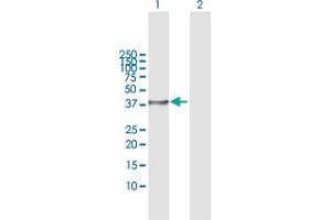 Western Blot analysis of STK19 expression in transfected 293T cell line by STK19 MaxPab polyclonal antibody. (STK19 antibody  (AA 1-364))