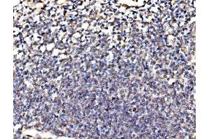 IHC analysis of Kinectin 1/KTN1 using anti-Kinectin 1/KTN1 antibody (ABIN7601096). (KTN1 antibody  (AA 283-827))