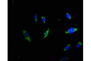 Immunofluorescence staining of U251 cells with ABIN7173353 at 1:66, counter-stained with DAPI. (Triadin antibody  (AA 75-161))