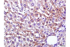 Paraformaldehyde-fixed, paraffin embedded mouse liver, Antigen retrieval by boiling in sodium citrate buffer (pH6) for 15min, Block endogenous peroxidase by 3% hydrogen peroxide for 30 minutes, Blocking buffer (normal goat serum) at 37°C for 20min, Antibody incubation with 	Leptin Polyclonal Antibody, Unconjugated  at 1:200 overnight at 4°C, followed by a conjugated secondary and DAB staining. (Leptin antibody  (AA 101-154))