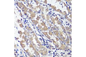Immunohistochemistry of paraffin-embedded human stomach using UBL3 antibody (ABIN6131930, ABIN6149849, ABIN6149850 and ABIN6220468) at dilution of 1:100 (40x lens).