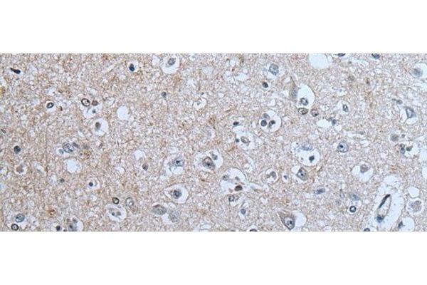 BRSK2 antibody