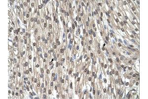 SHMT2 antibody was used for immunohistochemistry at a concentration of 4-8 ug/ml.