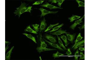 Immunofluorescence of purified MaxPab antibody to RARS on HeLa cell. (RARS antibody  (AA 1-660))