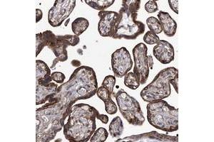 Immunohistochemical staining of human placenta with TJAP1 polyclonal antibody  shows strong granular cytoplasmic positivity in trophoblastic cells. (TJAP1 antibody)