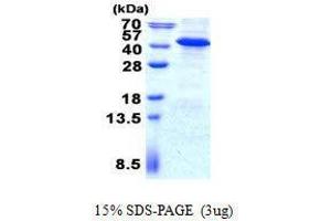 Figure annotation denotes ug of protein loaded and % gel used. (IMPAD1 Protein)