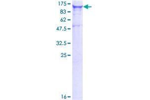 EIF2AK1 Protein (AA 1-630) (GST tag)