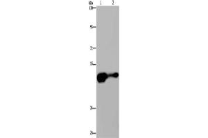 Gel: 6 % SDS-PAGE, Lysate: 40 μg, Lane 1-2: Mouse liver tissue, HepG2 cells, Primary antibody: ABIN7189742(AHRR Antibody) at dilution 1/430, Secondary antibody: Goat anti rabbit IgG at 1/8000 dilution, Exposure time: 2 minutes (AHRR antibody)