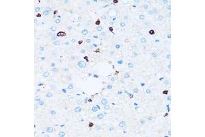 Immunohistochemistry of paraffin-embedded human liver using SPN antibody (ABIN5973813) at dilution of 1/100 (40x lens). (CD43 antibody)