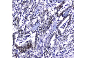 IHC analysis of MDC1 using anti-MDC1 antibody . (MDC1 antibody  (AA 534-626))