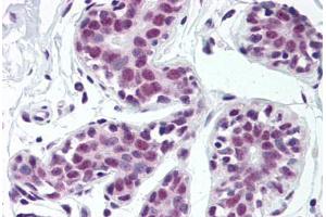 Human Breast (formalin-fixed, paraffin-embedded) stained with TARDBP antibody ABIN307182 at 5 ug/ml followed by biotinylated goat anti-rabbit IgG secondary antibody ABIN481713, alkaline phosphatase-streptavidin and chromogen. (TARDBP antibody  (Internal Region))