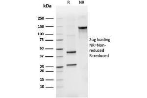 SDS-PAGE Analysis Purified BCL2L2 Mouse Monoclonal Antibody (CPTC-BCL2L2-2). (BCL2L2 antibody)