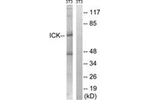 Western blot analysis of extracts from NIH-3T3 cells, treated with PBS 10uM 60', using ICK (Ab-159) Antibody. (ICK antibody  (AA 125-174))