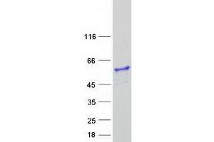 Western Blotting (WB) image for ATPase, H+ Transporting, Lysosomal 50/57kDa, V1 Subunit H (ATP6V1H) (Transcript Variant 1) protein (Myc-DYKDDDDK Tag) (ABIN2715065)