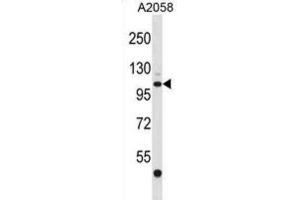 Western Blotting (WB) image for anti-ER Degradation Enhancer, Mannosidase alpha-Like 3 (EDEM3) antibody (ABIN2998830)