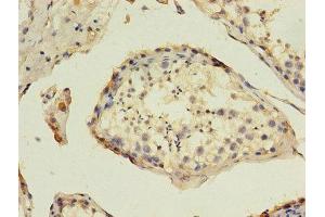 Immunohistochemistry of paraffin-embedded human testis tissue using ABIN7155031 at dilution of 1:100 (HAVCR1 antibody  (AA 21-290))
