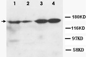 Western Blot analysis of ROCK2 expression from cell extracts with ROCK2 polyclonal antibody . (ROCK2 antibody  (N-Term))