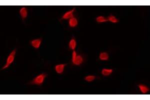 ABIN6268797 staining HT29 by IF/ICC. (EZH1 antibody  (Internal Region))