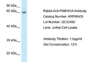 Western Blotting (WB) image for anti-Family with Sequence Similarity 161, Member A (FAM161A) (Middle Region) antibody (ABIN2788448) (FAM161A antibody  (Middle Region))