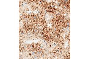 Immunohistochemical analysis of paraffin-embedded human brain tissue using B performed on the Leica® BOND RXm. (GFAP antibody)