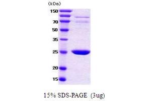 SDS-PAGE (SDS) image for 14-3-3 alpha + beta (YWHAB) (AA 1-246) protein (ABIN667713) (YWHAB Protein (AA 1-246))