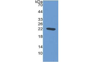 WB of Protein Standard: different control antibodies  against Highly purified E. (NOS2 ELISA Kit)