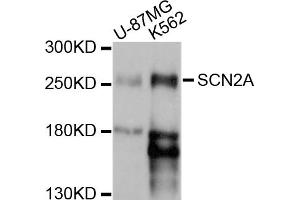 Western blot analysis of extracts of various cell lines, using SCN2A antibody (ABIN5998750) at 1/1000 dilution. (SCN2A antibody)
