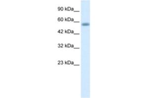 Western Blotting (WB) image for anti-Kelch-Like 36 (KLHL36) antibody (ABIN2461004) (KLHL36 antibody)