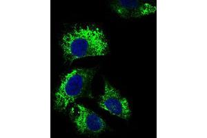 Immunofluorescence analysis of Hela cells using IL2RA mouse mAb (green).