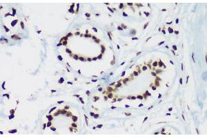 Immunohistochemistry of paraffin-embedded Human breast using TriMethyl-Histone H3-K64 Polyclonal Antibody at dilution of 1:100 (40x lens). (Histone 3 antibody  (3meLys64))