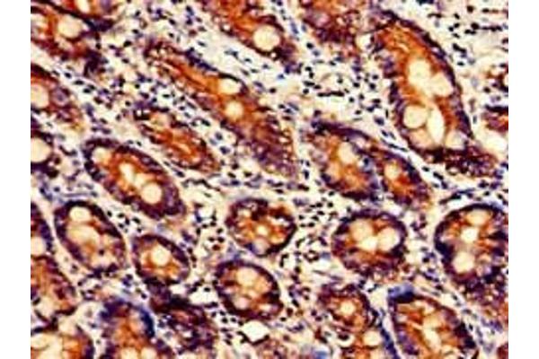 UGT1A9 antibody  (AA 277-473)
