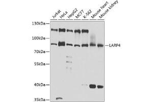 Western blot analysis of extracts of various cell lines, using L antibody (ABIN6132079, ABIN6143092, ABIN6143093 and ABIN6220849) at 1:1000 dilution. (LARP4 antibody  (AA 1-120))