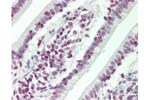 Human Small Intestine: Formalin-Fixed, Paraffin-Embedded (FFPE) (HOXC4 antibody  (AA 197-225))