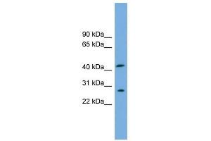 RABEPK antibody used at 1 ug/ml to detect target protein. (RABEPK antibody  (N-Term))