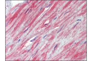 Prostate, fibromuscular stroma, Human: Formalin-Fixed, Paraffin-Embedded (FFPE) (TRPC1 antibody  (Trp1))