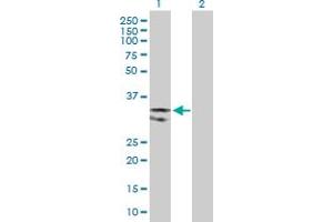 Western Blot analysis of UNG expression in transfected 293T cell line by UNG MaxPab polyclonal antibody. (UNG antibody  (AA 1-304))