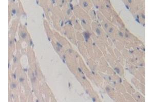 Detection of TOR1A in Mouse Heart Tissue using Polyclonal Antibody to Torsin 1A (TOR1A)