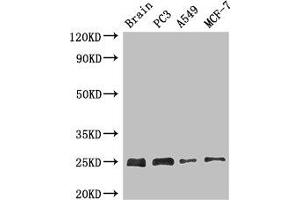 Western Blot Positive WB detected in: Mouse brain tissue, PC-3 whole cell lysate, A549 whole cell lysate, MCF-7 whole cell lysate All lanes: APOPT1 antibody at 2. (APOPT1 antibody  (AA 40-150))