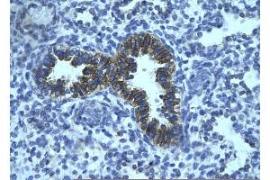 Rabbit Anti-PHF16 Antibody       Paraffin Embedded Tissue:  Human bronchiole epithelium   Cellular Data:  Epithelial cells of renal tubule  Antibody Concentration:   4. (PHF16 antibody  (Middle Region))