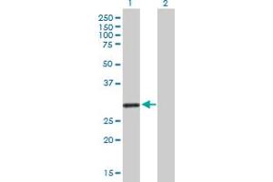 Western Blot analysis of KCNRG expression in transfected 293T cell line by KCNRG MaxPab polyclonal antibody. (KCNRG antibody  (AA 1-272))