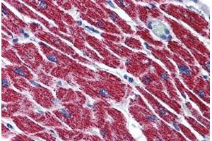Human Heart: Formalin-Fixed, Paraffin-Embedded (FFPE) (HADH antibody  (AA 205-315))