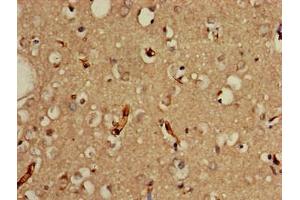 Immunohistochemistry of paraffin-embedded human brain tissue using ABIN7164093 at dilution of 1:100 (PRDM2 antibody  (AA 733-961))